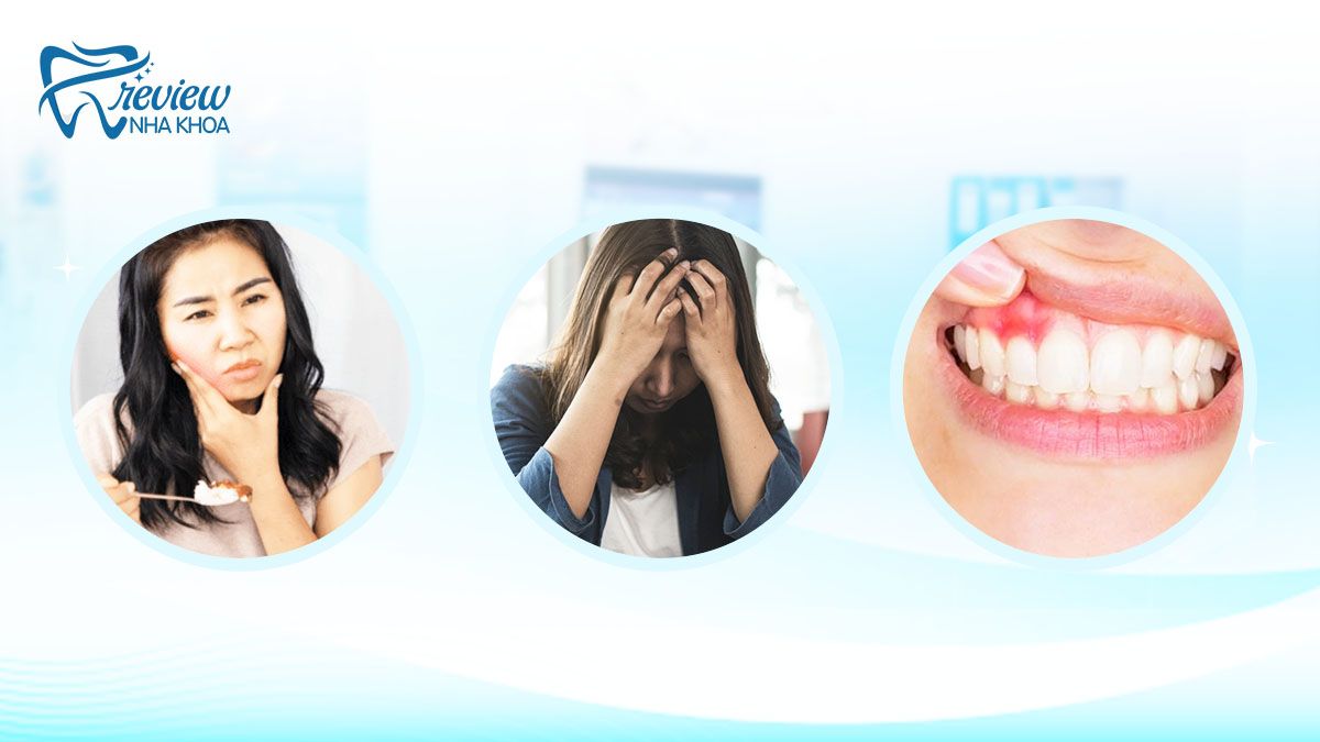 Những ảnh hưởng của hàm hô nặng đối với tình trạng răng miệng