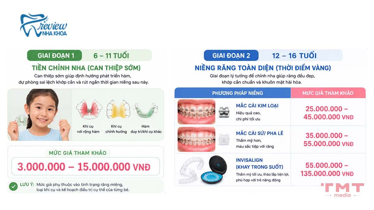 Chi tiết giá niềng răng cho trẻ em theo từng giai đoạn phát triển
