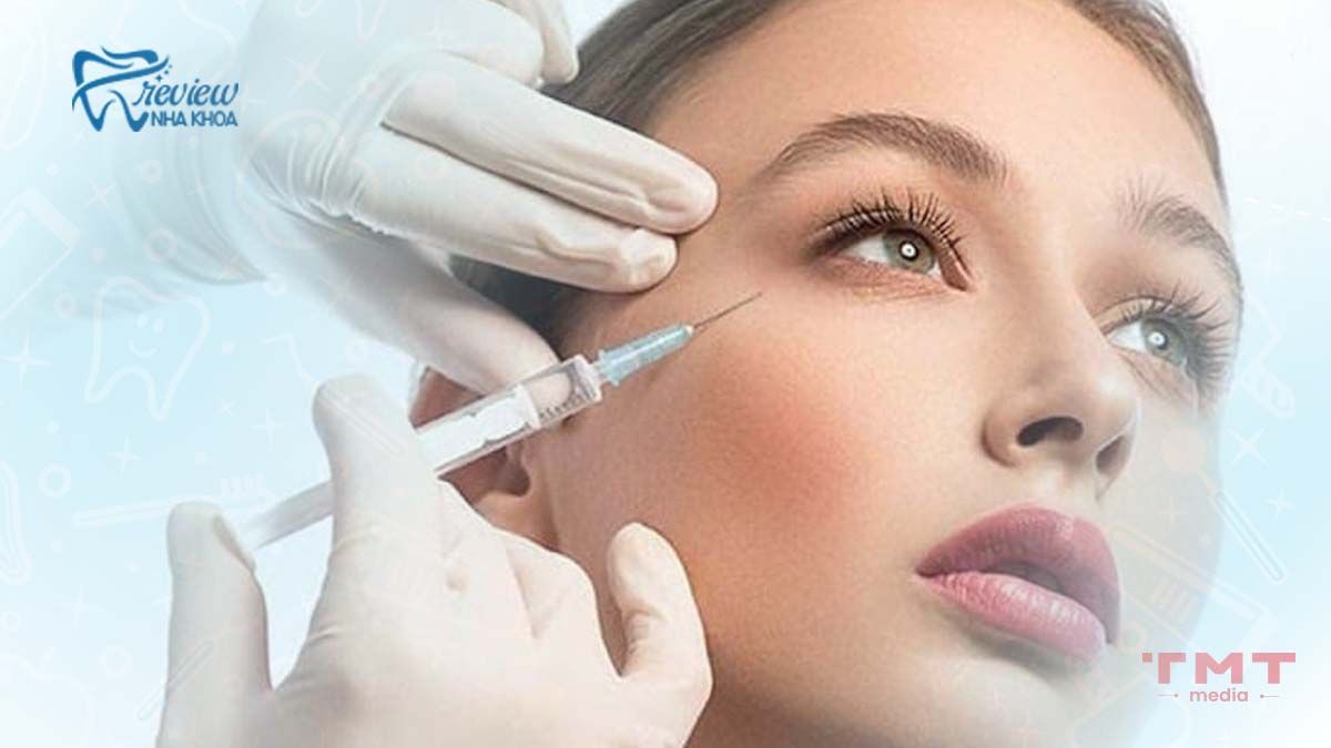Giải pháp y tế khi hóp má nặng (sau khi tháo niềng)