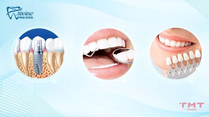 Các phương pháp giúp khôi phục răng đã mất