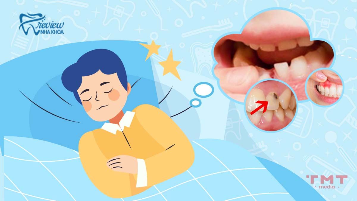 Giải mã việc ngủ mơ răng lung lay theo khoa học và những gì nên làm