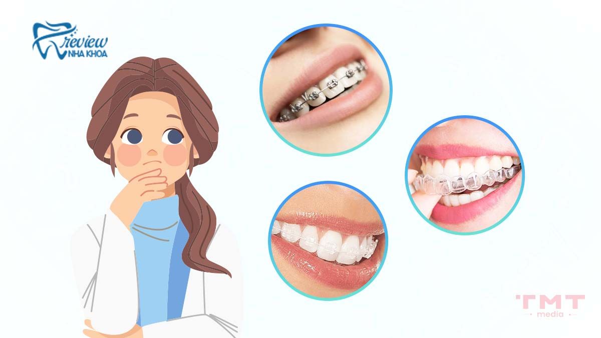 Phương pháp niềng răng nào tốt nhất cho bạn?