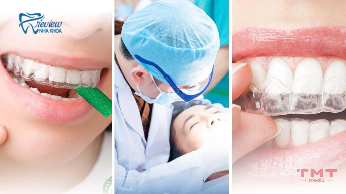 Cách phòng tránh đau khi mới niềng hoặc thay khay