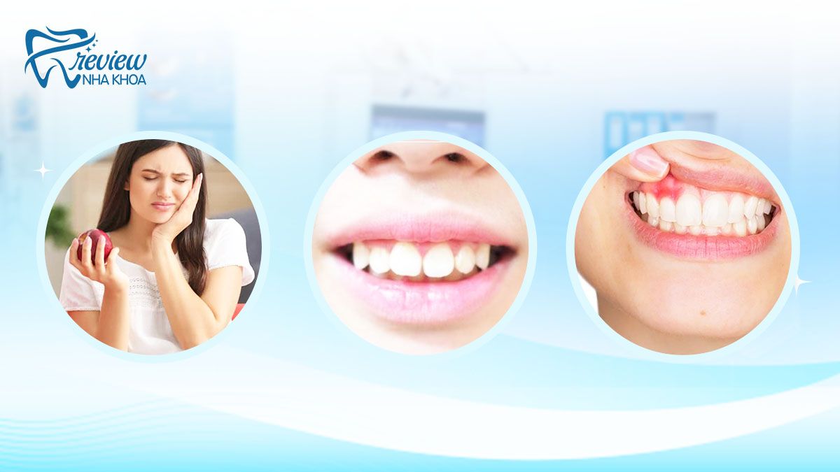 Răng vẩu nhẹ gây ra ảnh hưởng như thế nào?