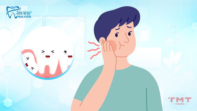 Người có 29 cái răng có ảnh hưởng gì đến sức khỏe răng miệng không?