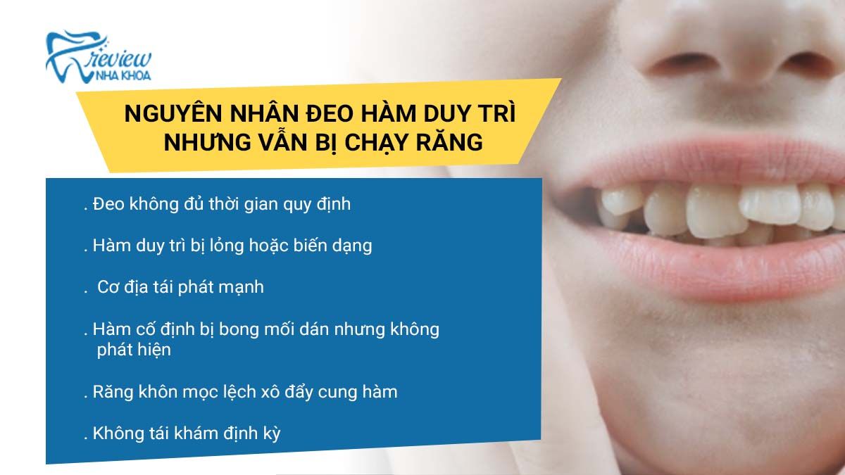 Vì sao đeo hàm duy trì vẫn bị chạy răng?