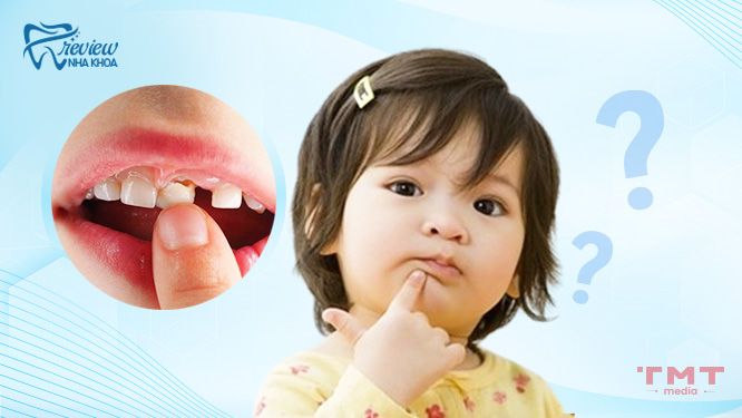 Dấu hiệu nhận biết thay răng sữa ở trẻ?