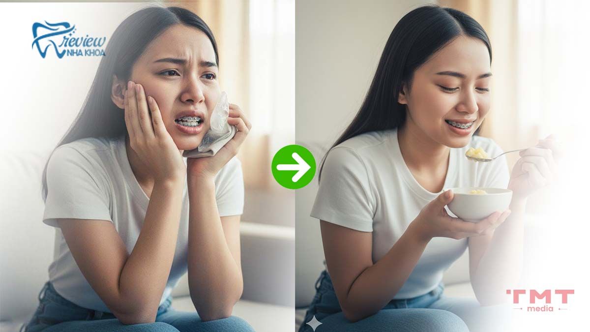 Xử lý các vấn đề thường gặp khi niềng