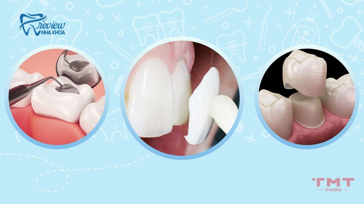 Răng mẻ có ảnh hưởng gì đến sức khỏe? Và cách khắc phục 