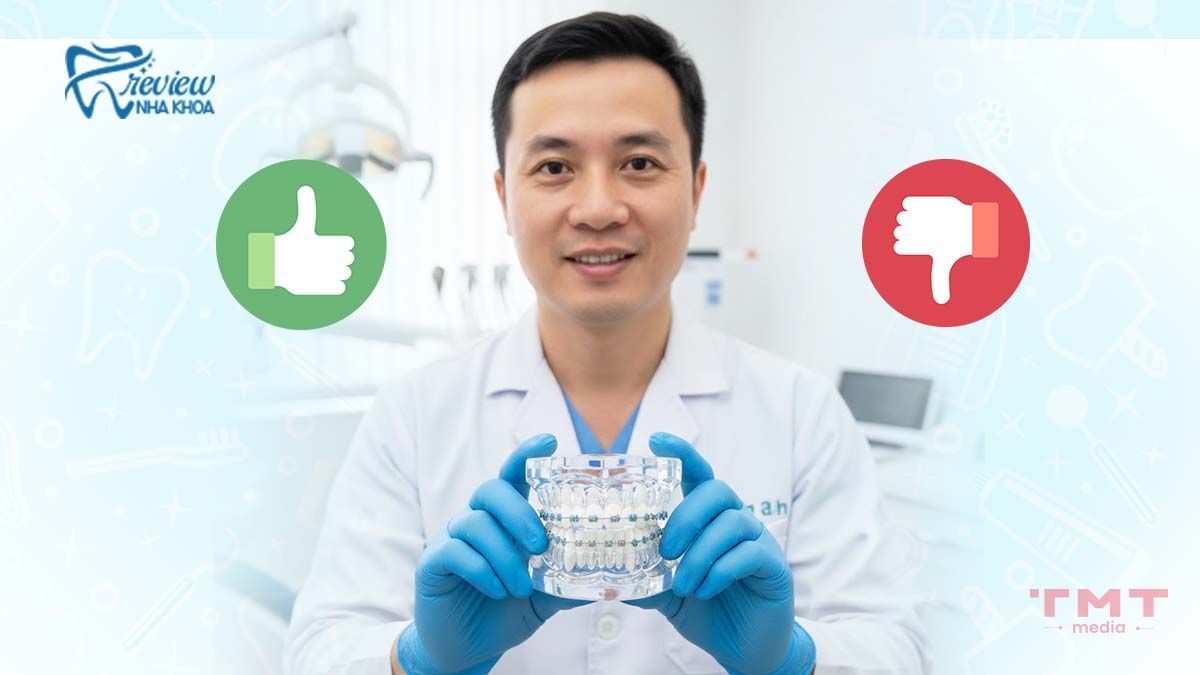  Mắc cài pha lê có tốt không? Đánh giá dựa trên chuyên môn