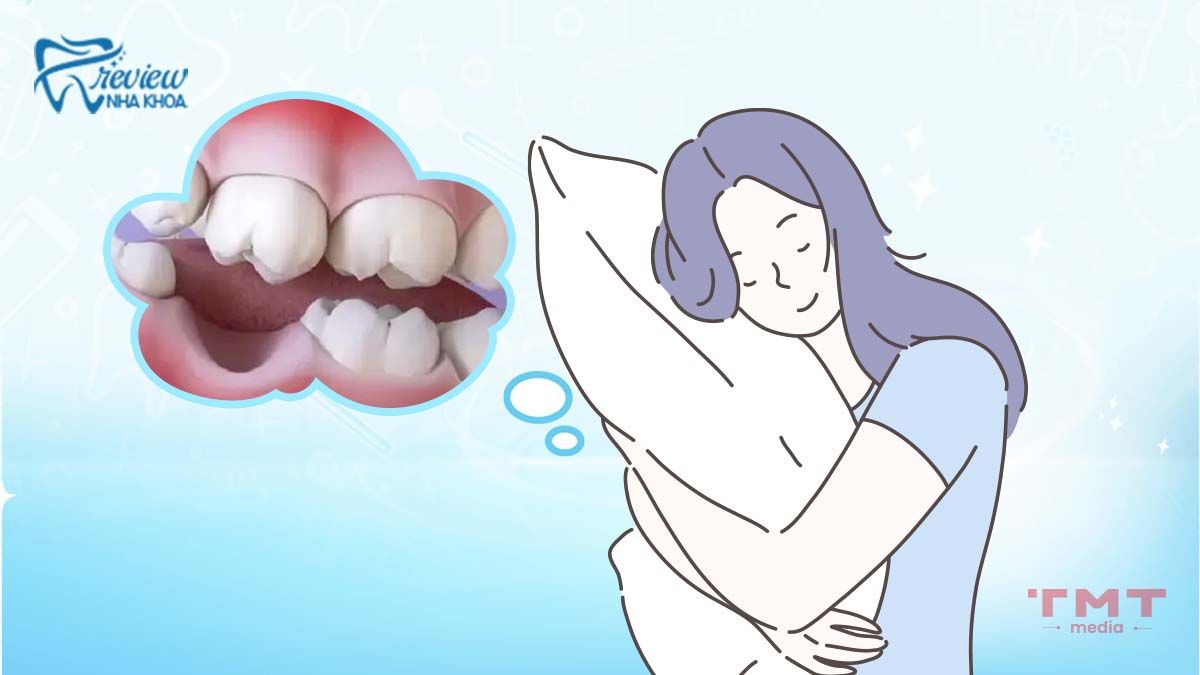 Tại sao lại nằm mơ rụng răng hàm dưới?