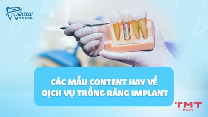 Các mẫu content hay về dịch vụ trồng răng Implant