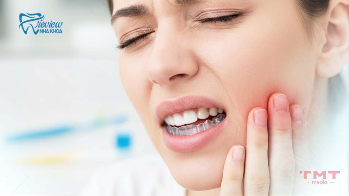 Các dấu hiệu đau khi niềng răng trong suốt