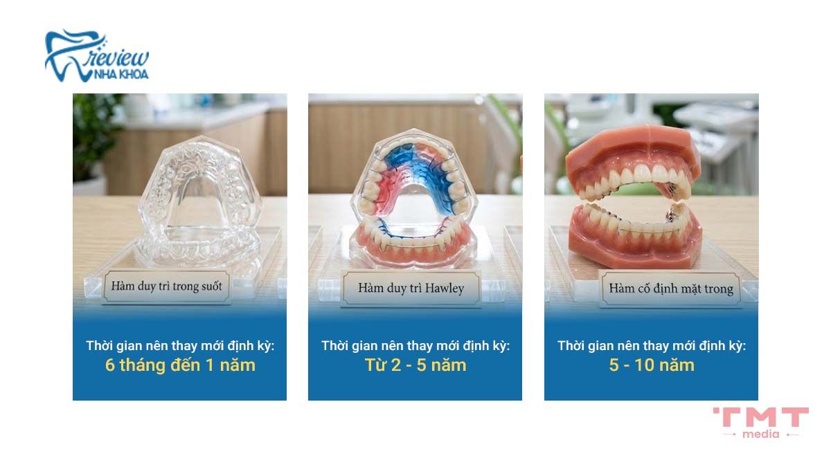 Bao lâu cần thay hàm duy trì?