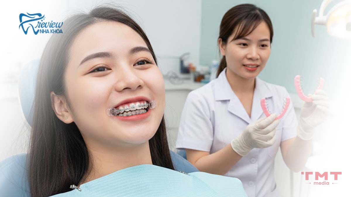 Niềng răng mắc cài pha lê là gì? Khác gì so với mắc cài thông thường?