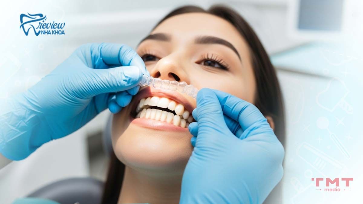 Niềng răng trong suốt Invisalign công nghệ hiện đại