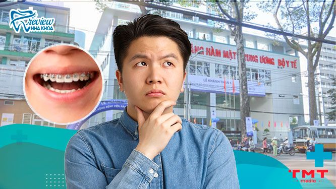 Có nên niềng răng ở Bệnh viện Răng Hàm Mặt TPHCM không? 