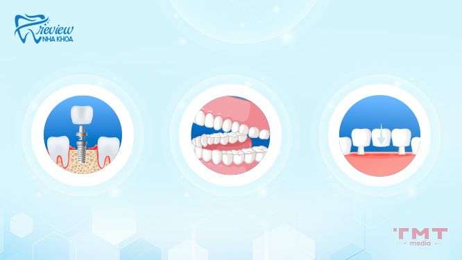 Các phương pháp khôi phục răng đã mất hiệu quả hiện nay