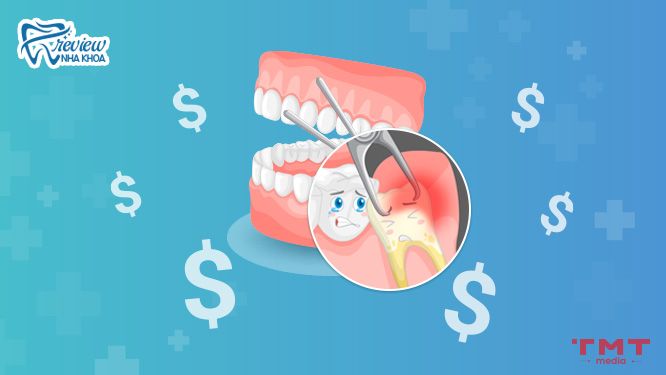 Chi phí nhổ răng khôn hàm dưới là bao nhiêu