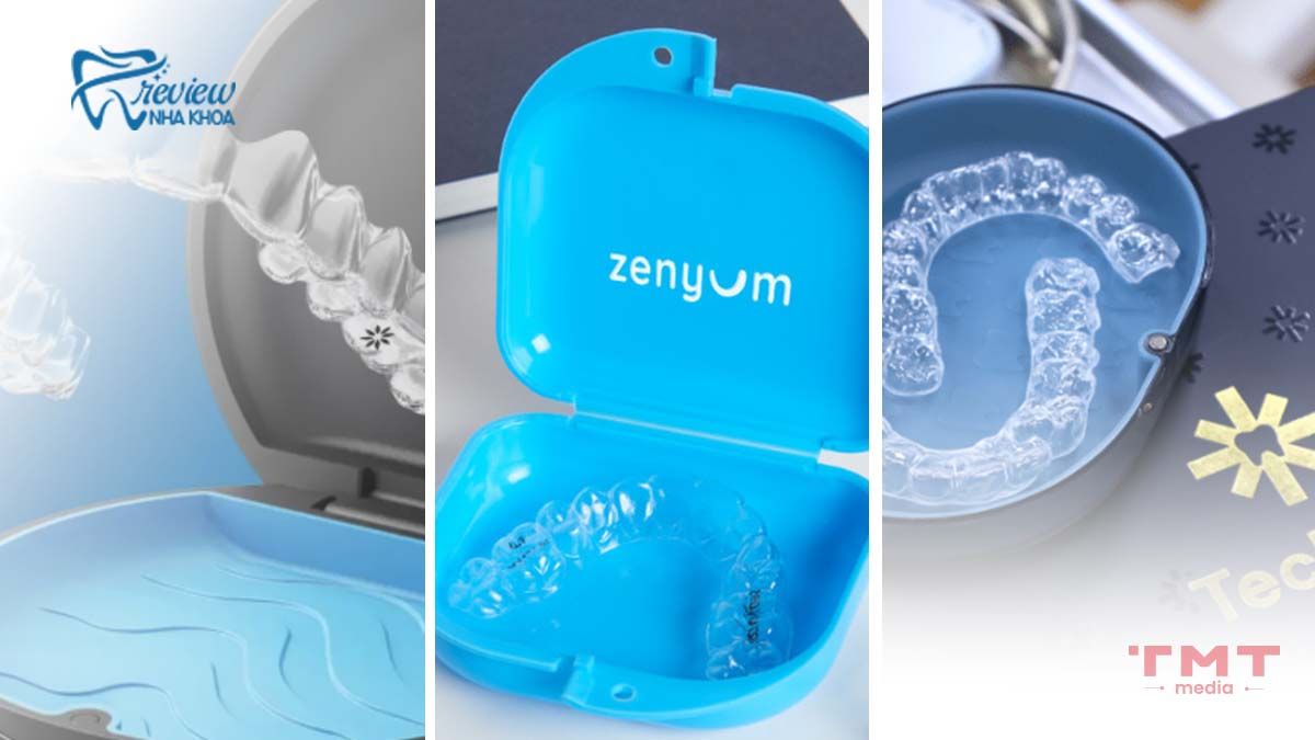 Các loại niềng răng trong suốt phổ biến hiện nay