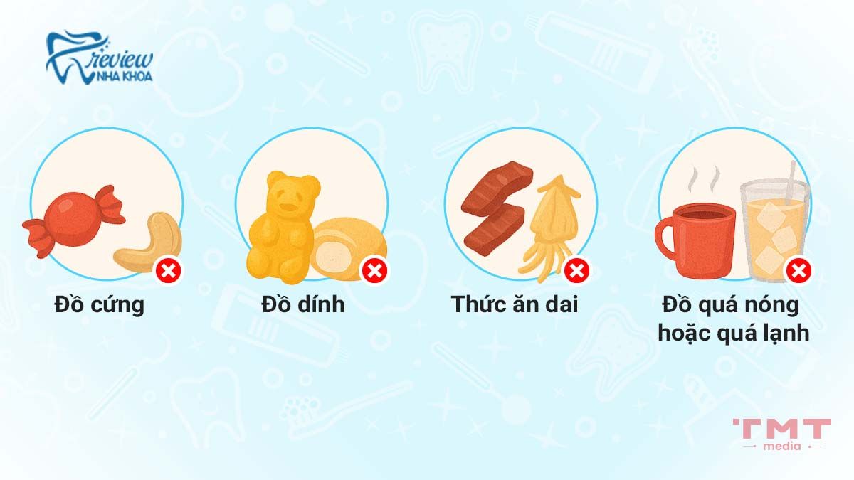 Niềng răng không nên ăn gì? Những thực phẩm nên tránh