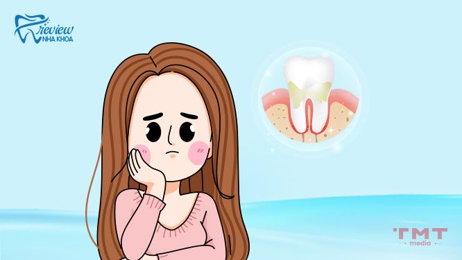 Làm sao để phòng tránh tình trạng răng nhiễm Fluor