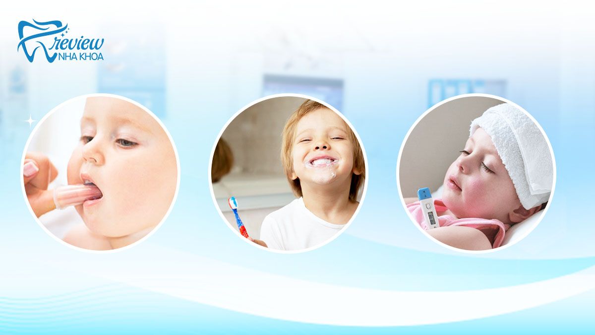Cách xử lý đúng chuẩn khi chăm sóc cho trẻ 5 tuổi mọc răng hàm