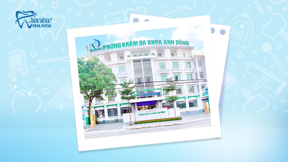 Nha khoa Anh Dũng niềng răng Thái Bình có mắc cài thép 6 cánh chất lượng