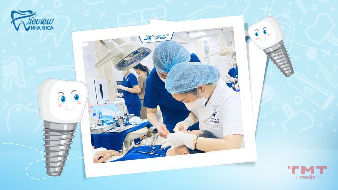 Nha khoa Lạc Việt Intech sử dụng Robot định vị X-Guide độc quyền trong trồng răng Implant ở Hải Phòng
