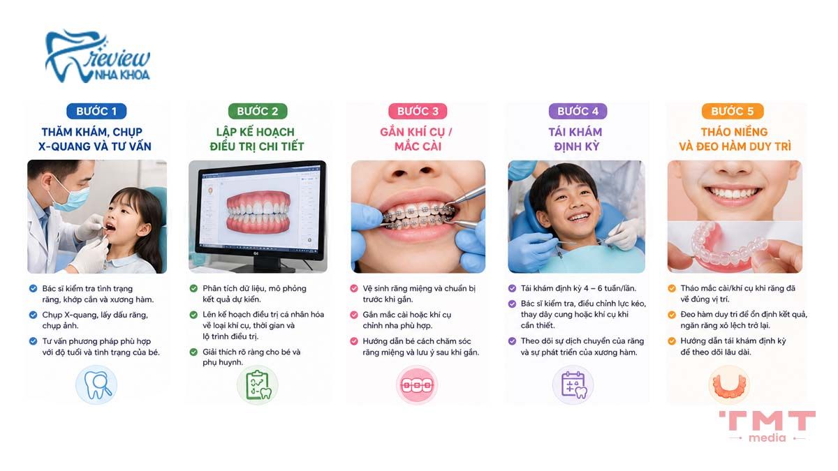 Quy trình niềng răng cho trẻ tại nha khoa
