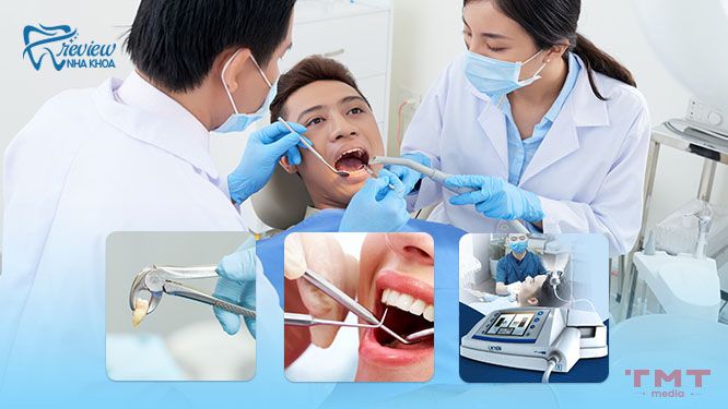 quy trình nhổ răng khôn hàm trên phổ biến