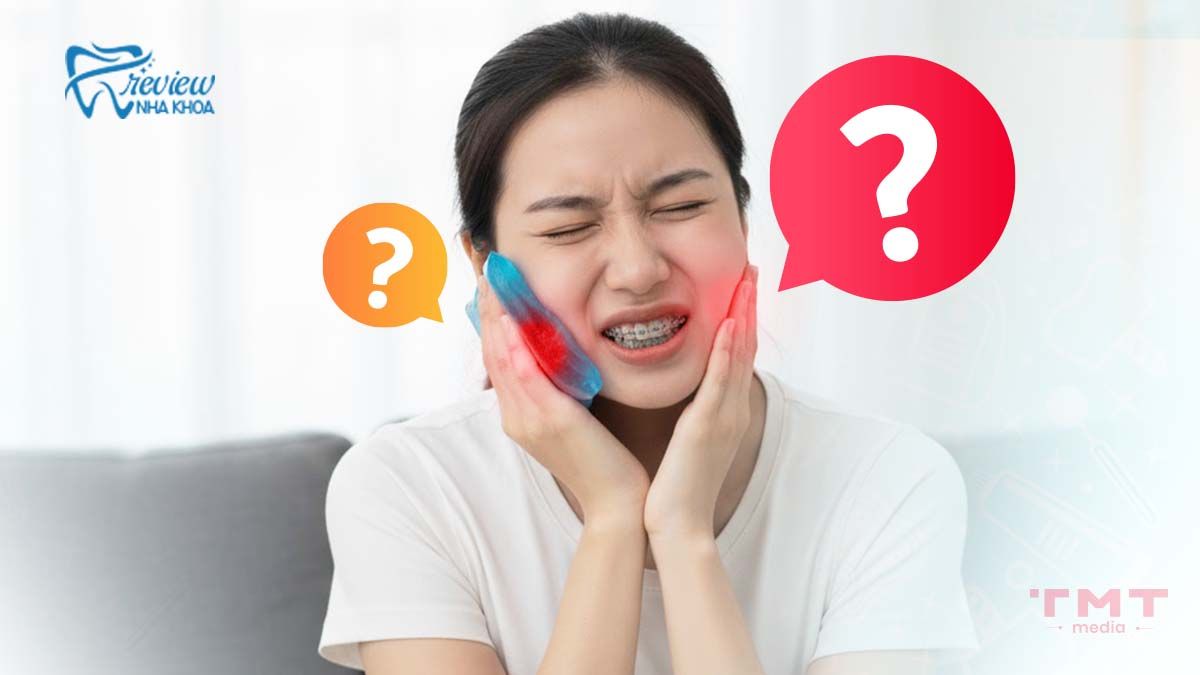 Vì sao niềng răng lại bị đau, ê buốt?