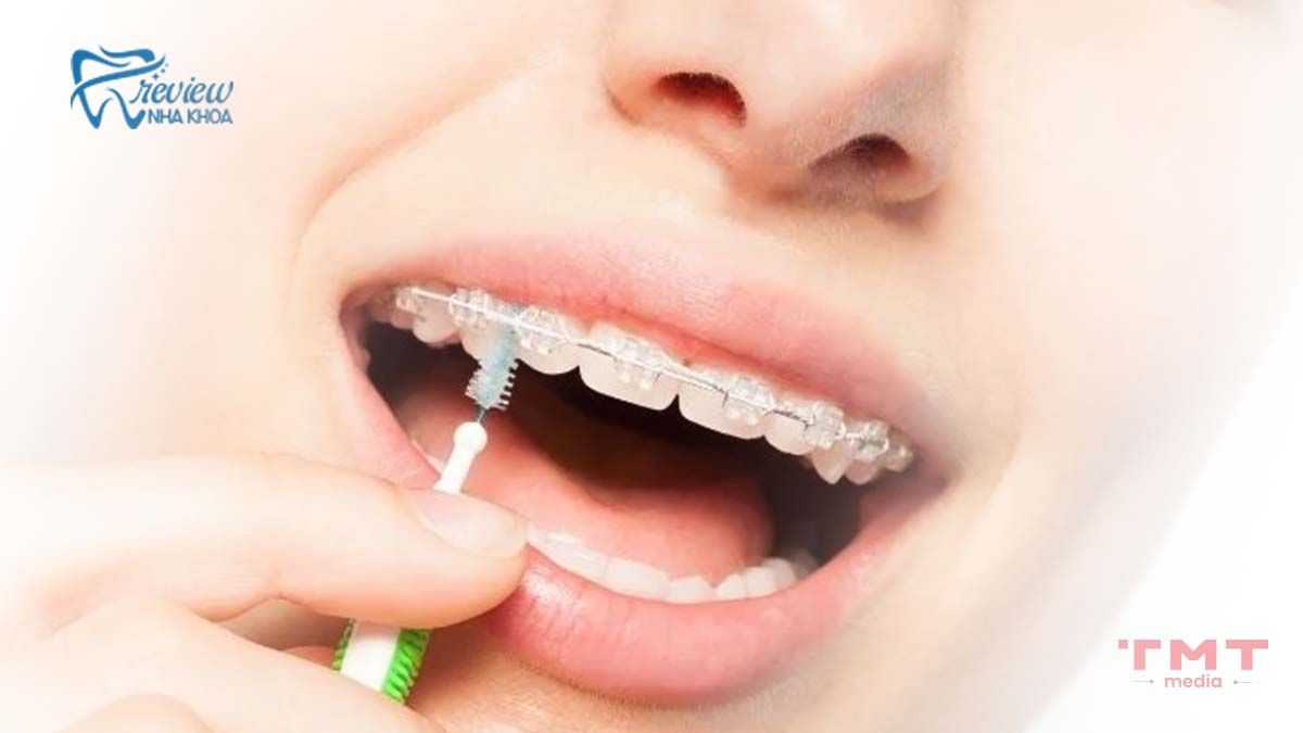 Vệ sinh răng miệng đúng cách