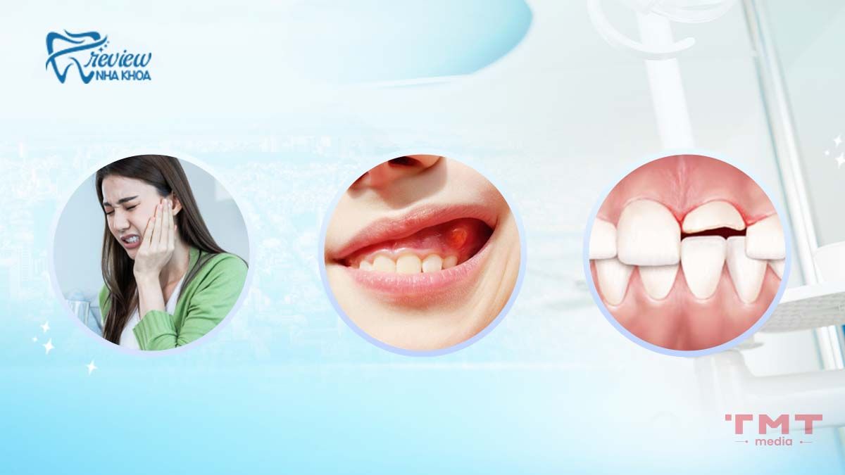 Hô hàm mang lại những hậu quả gì đến sức khỏe răng miệng?