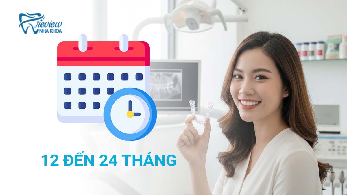  Niềng răng Invisalign bao lâu? Thời gian phụ thuộc vào yếu tố nào?
