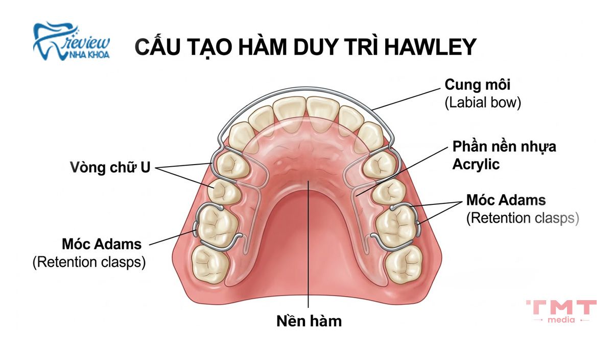 Cấu tạo chi tiết của hàm duy trì Hawley