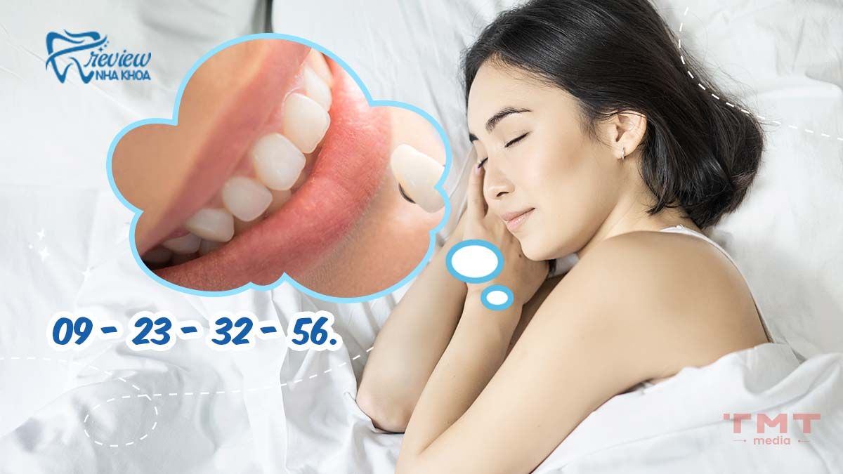 Nằm mơ thấy đi làm răng sứ liên quan đến số mấy?