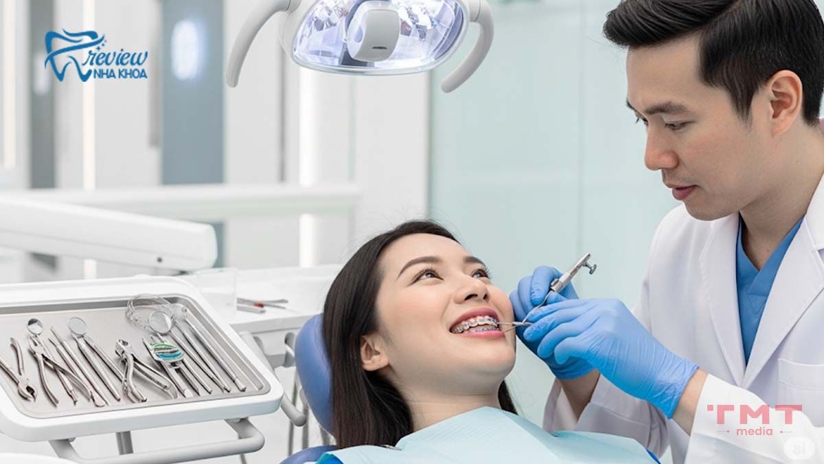 Niềng răng bằng mắc cài kim loại