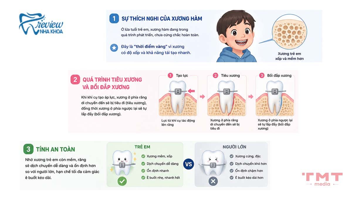 Cơ chế dịch chuyển răng khi niềng