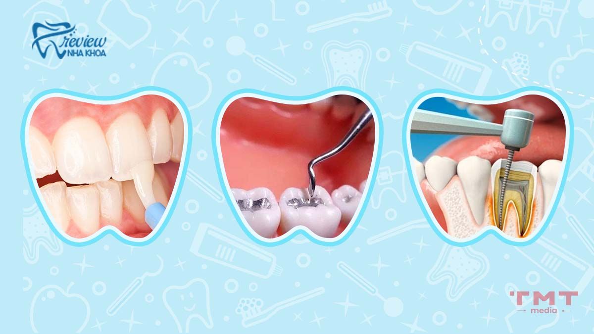 Điều trị chuyên sâu răng bị nhạy cảm tại nha khoa