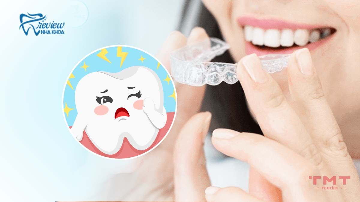 Niềng răng trong suốt có đau không?