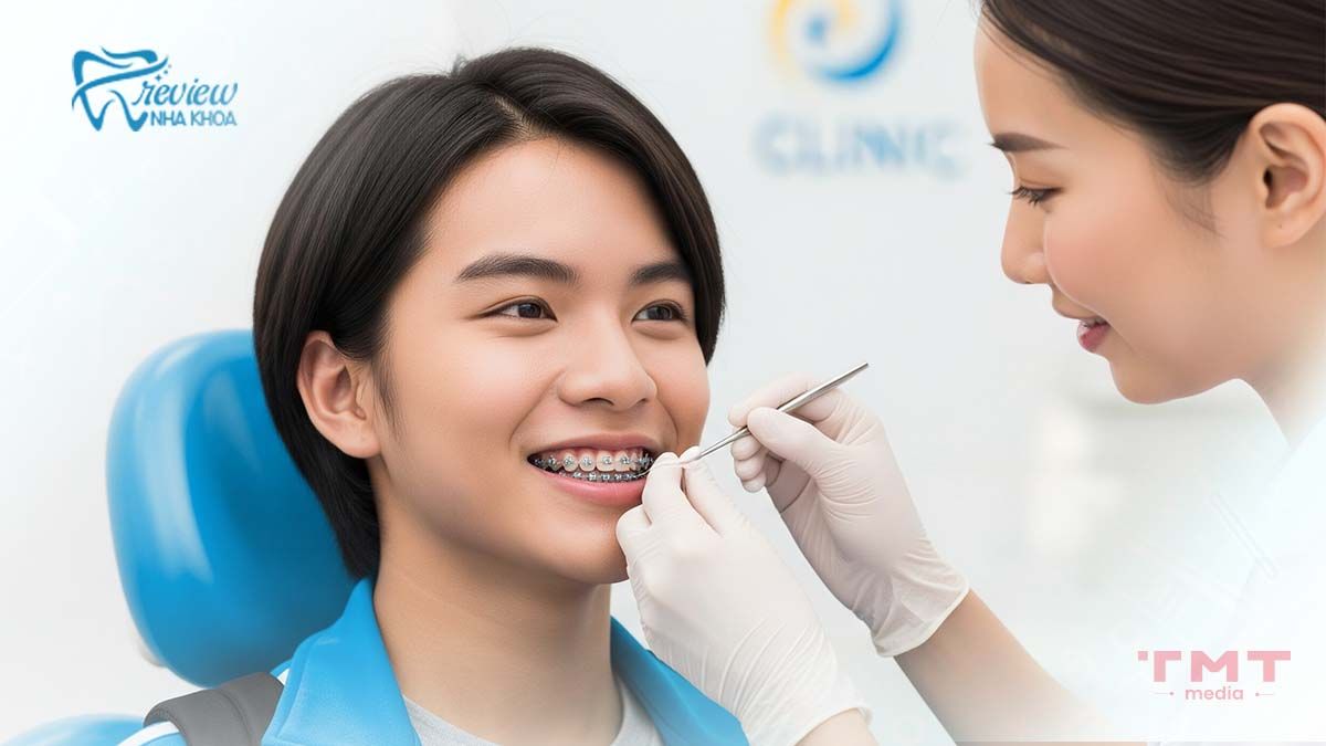 Nên niềng răng ở độ tuổi nào?Thanh thiếu niên (12 - 18 tuổi) độ tuổi niềng răng hiệu quả