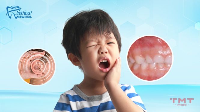 Dấu hiệu chứng tỏ trẻ bị nghiến răng khi ngủ