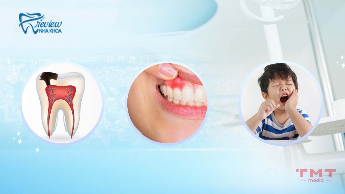 Ảnh hưởng của răng lệch lạc đến sức khỏe răng miệng