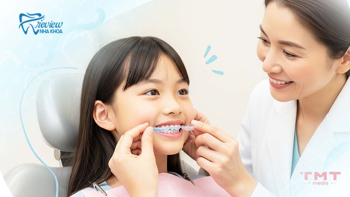 Trainer chỉnh nha can thiệp sớm cho trẻ em (7 - 12 tuổi)