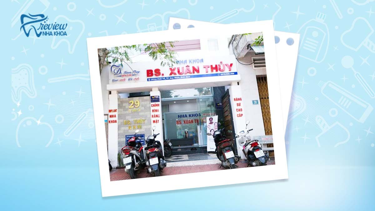 Nha khoa Dr. Xuân Thủy đầu tư thiết bị niềng răng hiện đại ở Quy Nhơn