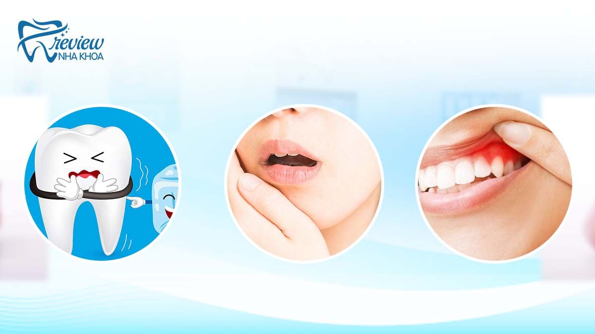 Triệu chứng khi bị sâu răng cấm là gì?