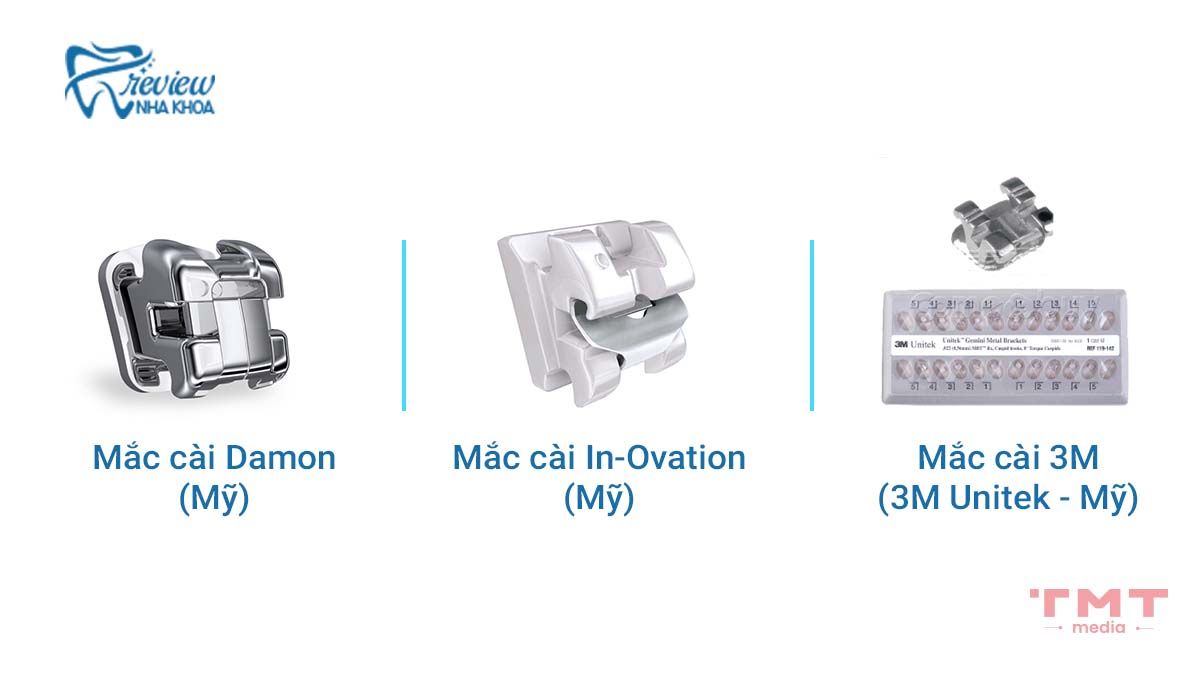 Mắc cài kim loại tự buộc có mấy loại? (Các thương hiệu phổ biến tại Việt Nam)