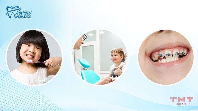 Cách xử lý răng bé mọc lệch vào trong