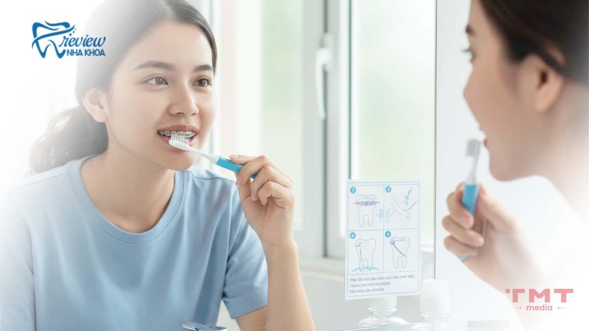 Chăm sóc răng miệng khi niềng răng mắc cài pha lê